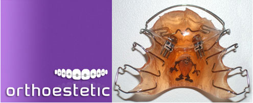 Removable Orthodontics